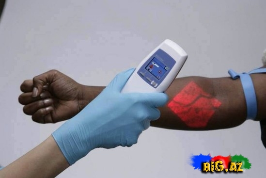 Bu cihazla damara iynə vurmaq asanlaşacaq - FOTO