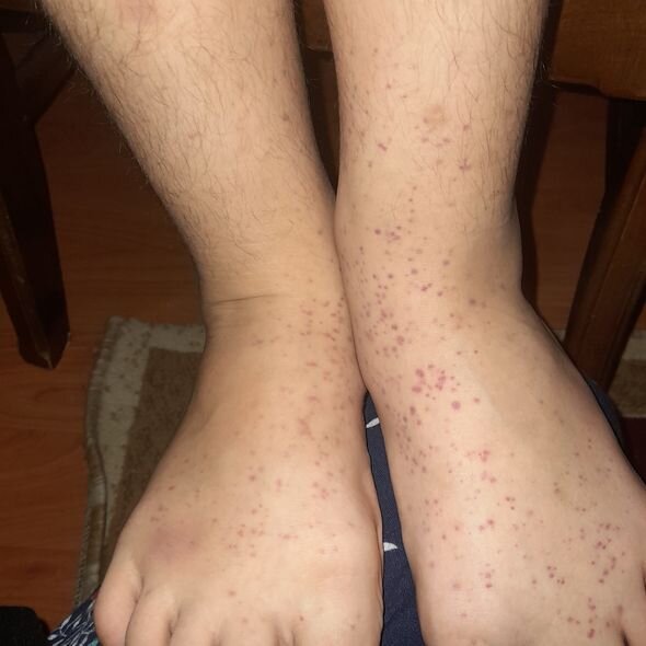 İki övladı ağır xəstəlikdən əziyyət çəkən ana fəryad edir: "Övladlarımı itirsəm, dəli olaram" - FOTO