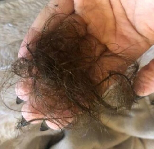 Üzündə ləkələr yaranan 29 yaşlı qadın həkimə getdi, eşitdiklərindən şoka düşdü - FOTOLAR