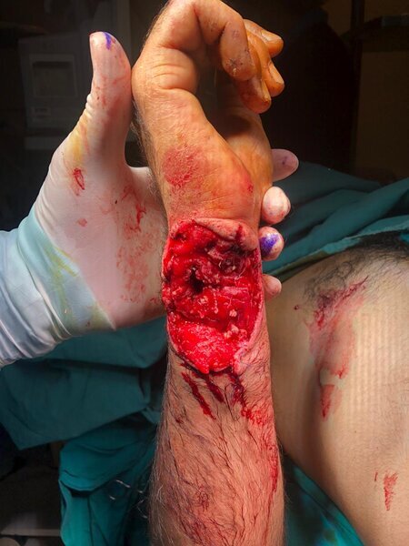 Məşhur plastik cərrahdan NÜMUNƏVİ ADDIM: Qazimizi pulsuz əməliyyat etdi - FOTO