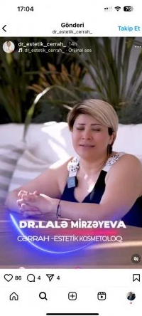 Lalə Mirzəyeva pasiyenti bu hala saldı-Fotofakt