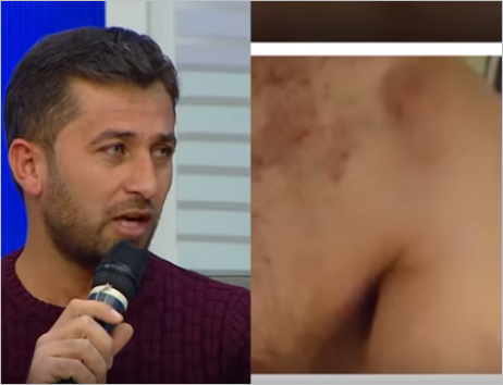 Azərbaycanda BİABIRÇILIQ - Gənci soyundurub kafenin qarşısına atdılar - FOTOLAR