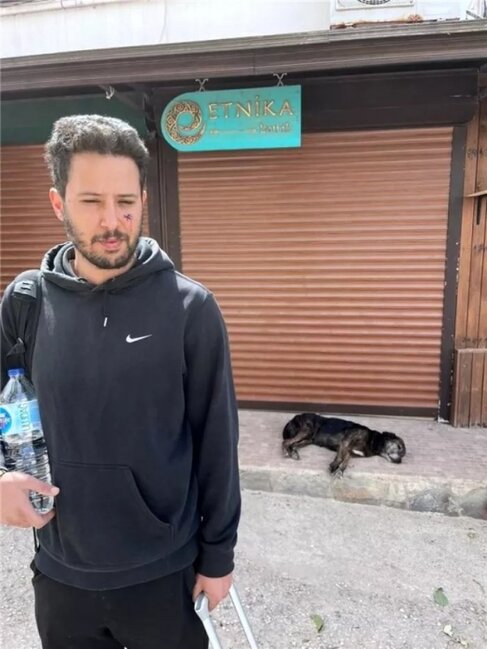 İt aktyorun üzünü dişlədi - FOTOLAR