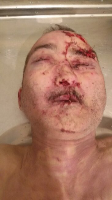 Maşınla vurulub öldürülən piyadanın yaxınları axtarılır - FOTO