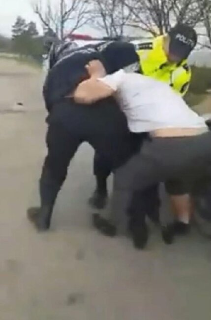 Sərxoş sürücü polisin barmağını 9 dəqiqə dişlədi - FOTOLAR