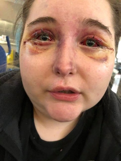 Tətildən qayıdan qız dəhşətli xəstəliyə tutuldu - FOTOLAR