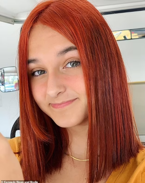 13 yaşlı qız evdə saçlarını boyamaq istədi - Gözü kor oldu - FOTO