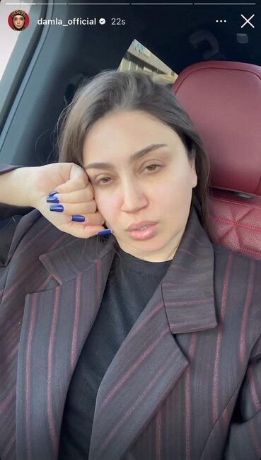 Damlanın makiyajsız görüntüsü təəccübləndirdi - Foto