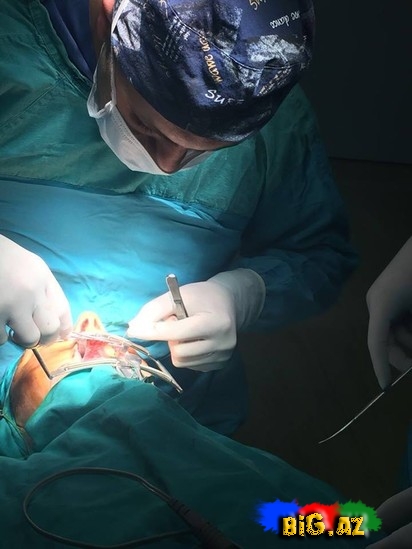Azərbaycanlı həkim 20 yaşlı qızı pulsuz əməliyyat etdi, həyata qaytardı