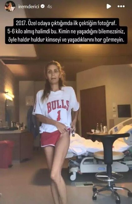 30 yaşlı Nihal Candanın ölümündən sonra 2 məşhurdan ŞOK anoreksiya ETİRAFI
