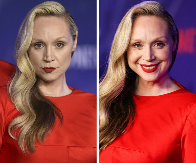 Təbəssüm etdikdə sanki başqa insana çevrilən 17 ULDUZ - FOTO