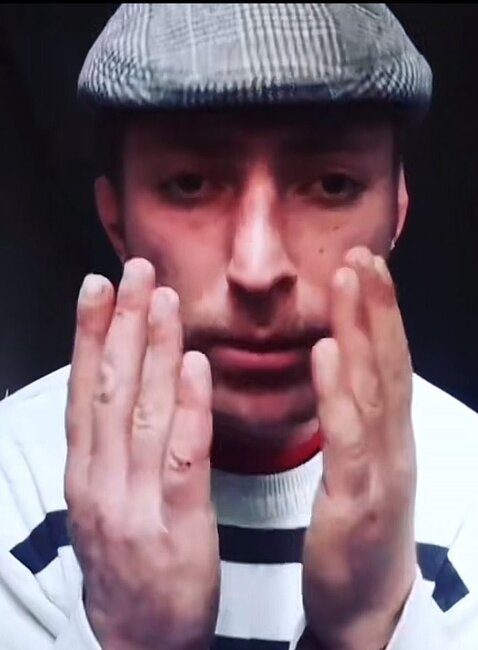 Azərbaycanda 32 yaşlı kişi başından vuruldu