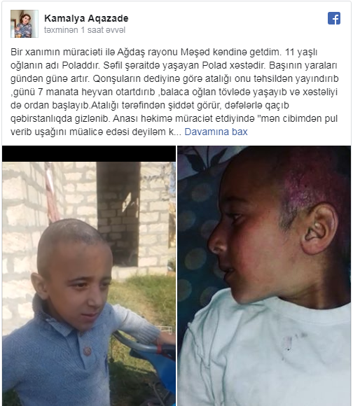 Azərbaycanda atalığından şiddət görən 11 yaşlı uşaq qəbiristanlıqda gizlənib - FOTO