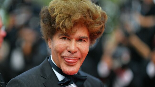 Əkiz qardaşının ölümündən 6 gün sonra vəfat etdi - FOTO