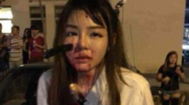 19 yaşlı qıza qarşı dəhşətli əməl: Üzünə bıçaq sapladılar - VİDEO