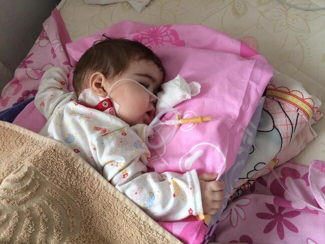 7 aylıq körpəyə nəcisindən dəhşətli infeksiya bulaşdı – VƏZİYYƏTİ AĞIRDIR