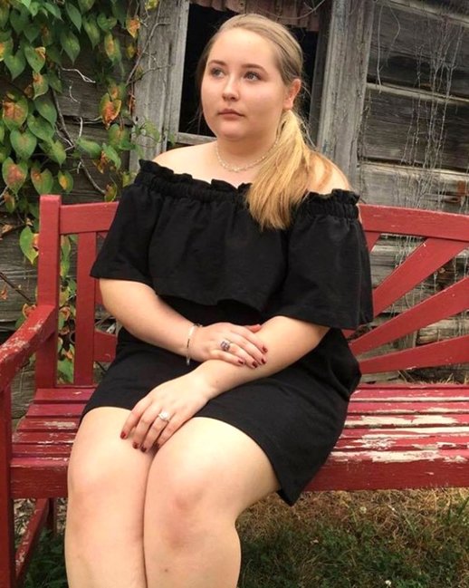 Tətildən qayıdan qız dəhşətli xəstəliyə tutuldu - FOTOLAR