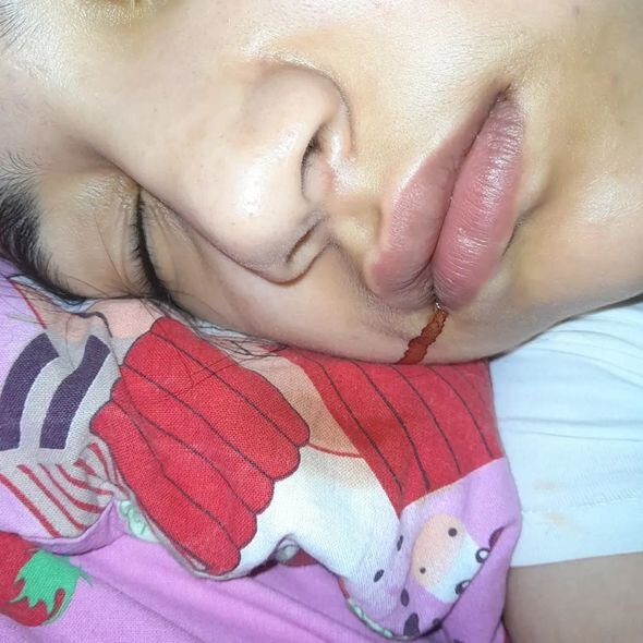 İki övladı ağır xəstəlikdən əziyyət çəkən ana fəryad edir: "Övladlarımı itirsəm, dəli olaram" - FOTO