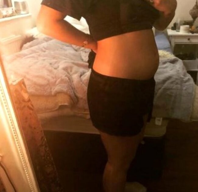 Üzündə ləkələr yaranan 29 yaşlı qadın həkimə getdi, eşitdiklərindən şoka düşdü - FOTOLAR