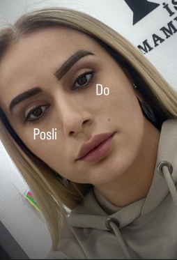 43 yaşlı Roza Zərgərli üzündə dəyişiklik edərək makiyajsız halını paylaşdı - FOTO