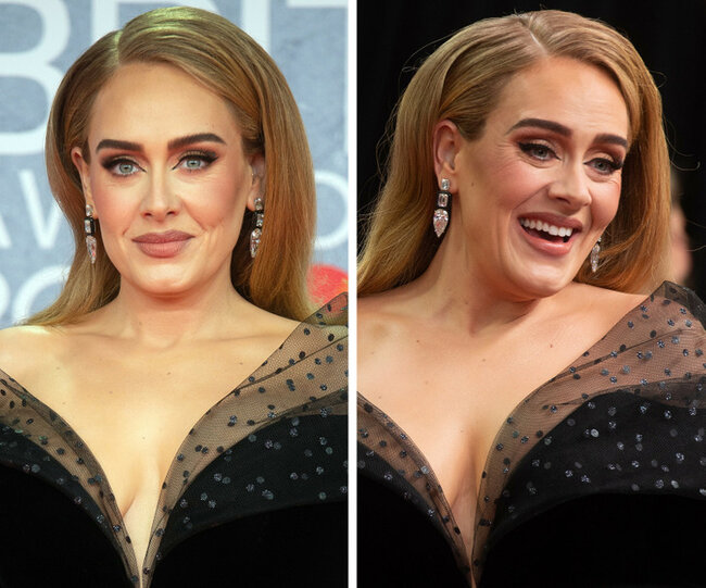 Təbəssüm etdikdə sanki başqa insana çevrilən 17 ULDUZ - FOTO