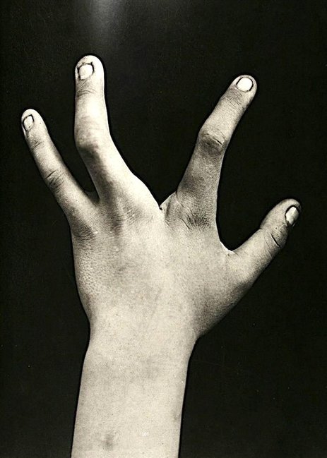 Başındakı buynuzla gəzən qadının fotoları görənləri dəhşətə gətirir