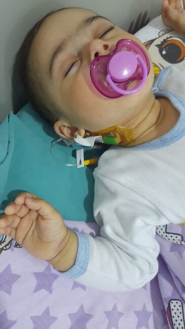 7 dəfə əməliyyat olunan balaca Rənanın dəstəyə ehtiyacı var - FOTO