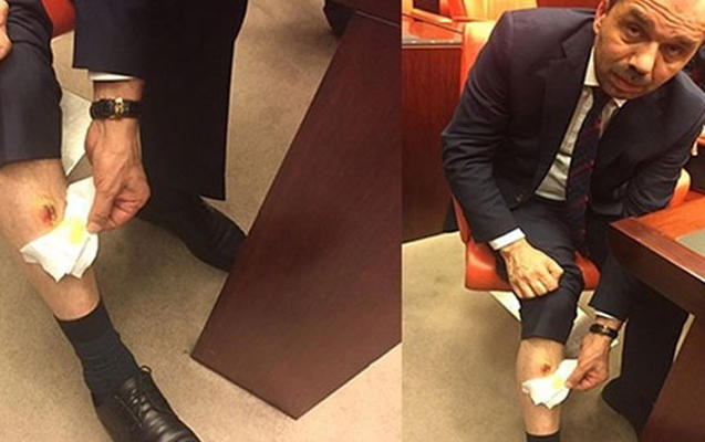 Milli Məclisdə DAVA: Deputatın ayağını dişlədilər - FOTO