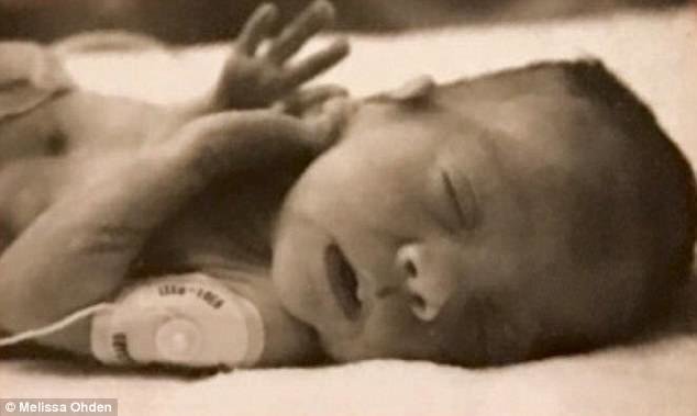 "Anam 8 aylığımda abort etdirdi, amma sağ qaldım" - anasını bağışlayan qadın - FOTO