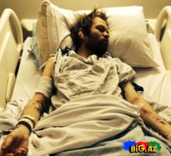 Məşhurların xəstəxana "selfie"ləri - FOTO