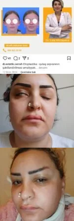 Lalə Mirzəyeva pasiyenti bu hala saldı-Fotofakt