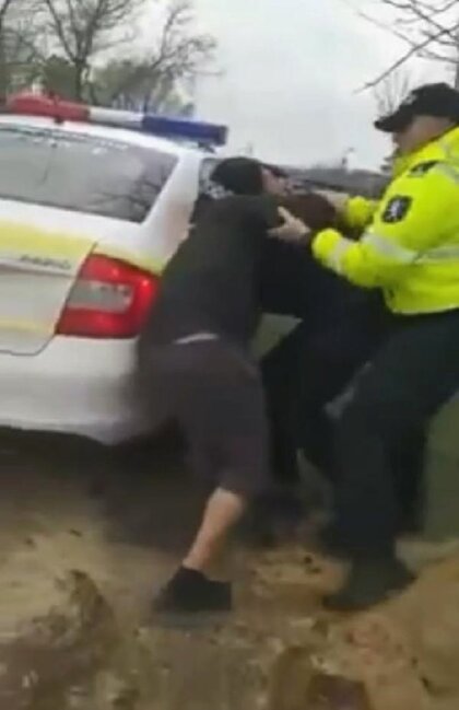 Sərxoş sürücü polisin barmağını 9 dəqiqə dişlədi - FOTOLAR