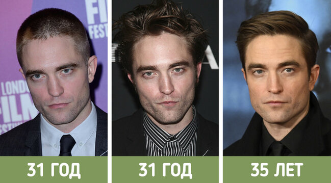 İllər ərzində sanki fərqli insanlara çevrilən ULDUZLAR - FOTO