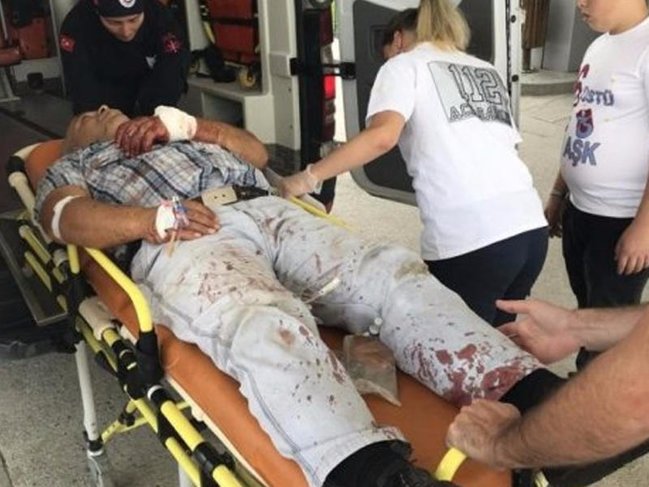 Ölkədə qurban kəsimi: Yaralı qəssablar xəstəxanalara axın edir - FOTO