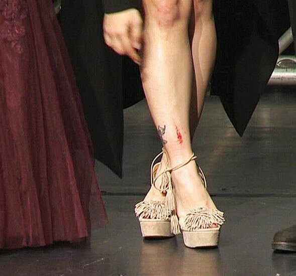 Qala gecəsində gərgin anlar: Aktrisanın ayağı burxuldu, yıxıldı - FOTOLAR