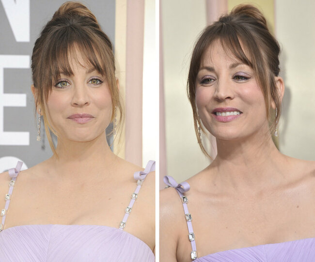 Təbəssüm etdikdə sanki başqa insana çevrilən 17 ULDUZ - FOTO