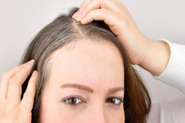 Ağ saçları necə yox etmək olar? –TƏBİİ ÜSULLAR