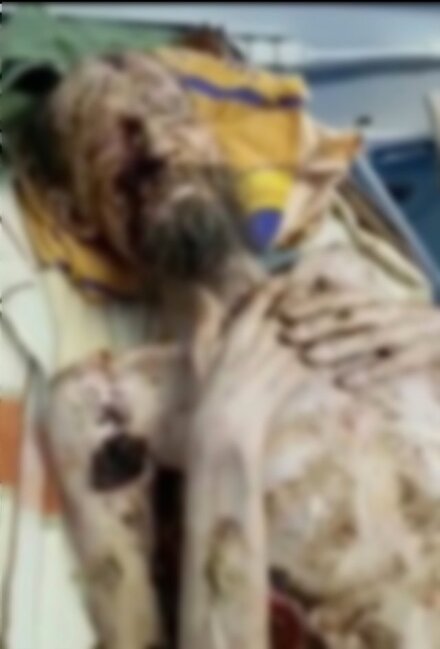 Ayının mağarasına apardığı adam 1 ay sonra tapıldı, bunu edərək sağ qalıb - FOTOLAR