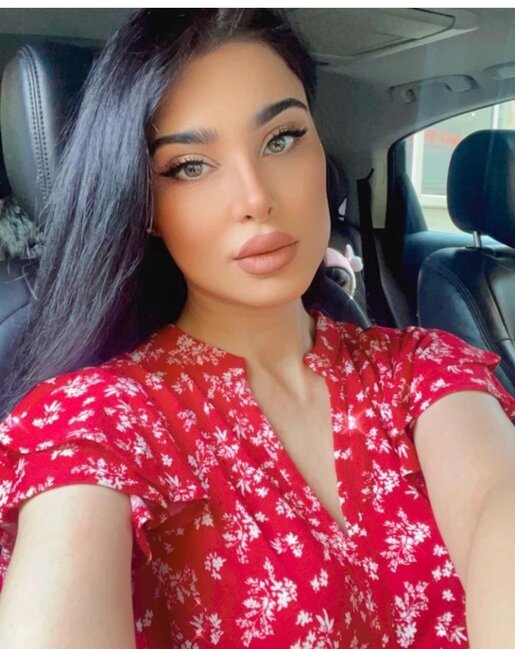 Məşhur azərbaycanlı müğənni görünüşü ilə GÖZ OXŞADI - FOTO