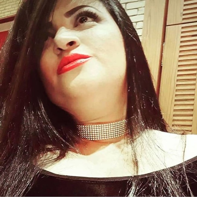 Bu da Aynur Dadaşovanın 