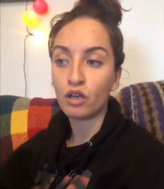 Üzündə ləkələr yaranan 29 yaşlı qadın həkimə getdi, eşitdiklərindən şoka düşdü - FOTOLAR