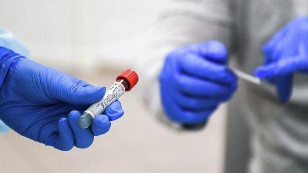 Özbəkistanda koronavirusa yoluxma sayında yeni anti-rekord qeydə alındı
