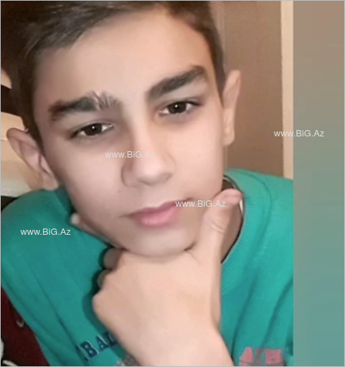 Faciəvi şəkildə ölən 12 yaşlı Rəvanın FOTOLARI