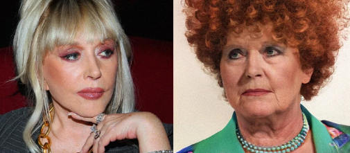 Estetika olmasaydı, məşhurlar necə görünərdi?