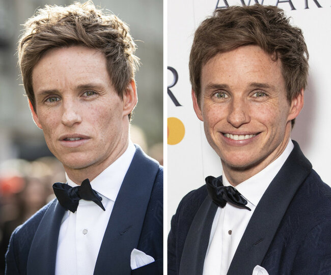 Təbəssüm etdikdə sanki başqa insana çevrilən 17 ULDUZ - FOTO