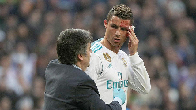 Ronaldunun qaşı yarıldı - "Real Madrid" 7 qolla qalib oldu - VİDEO - FOTO