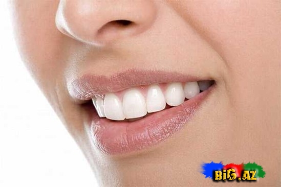 Dişlərin vaxtından əvvəl tökülməsinin 7 səbəbi