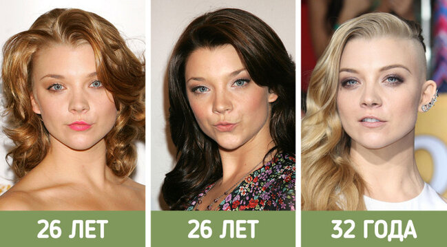 İllər ərzində sanki fərqli insanlara çevrilən ULDUZLAR - FOTO