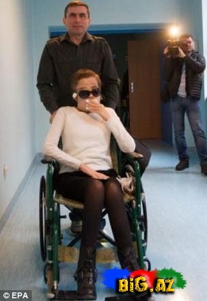 26 yaşlı qız yeni sifətə sahib oldu - FOTO