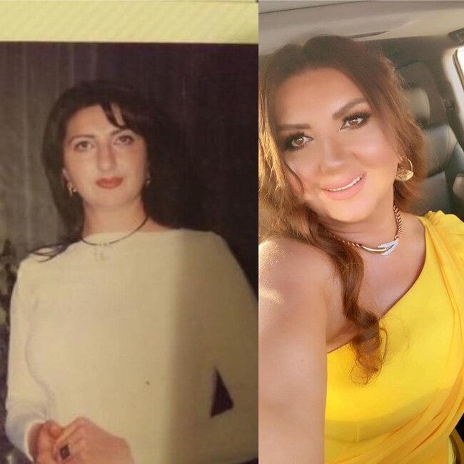 Nazilə 10 il əvvəl və indi - Görənlər MƏƏTTƏL QALDI: Nə gündəsən...